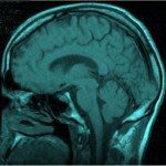 No modest proposal: Bioengineering humans for global warming